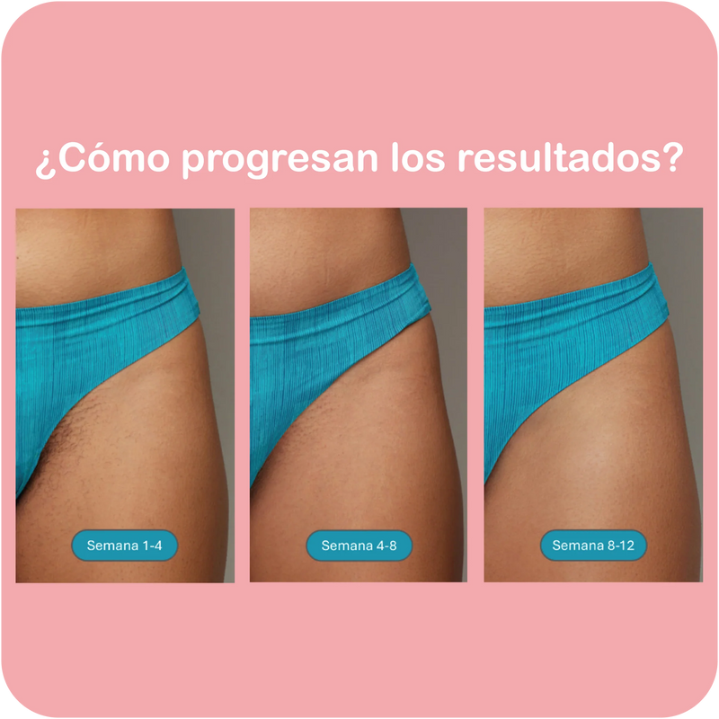 Mini depiladora láser recargable